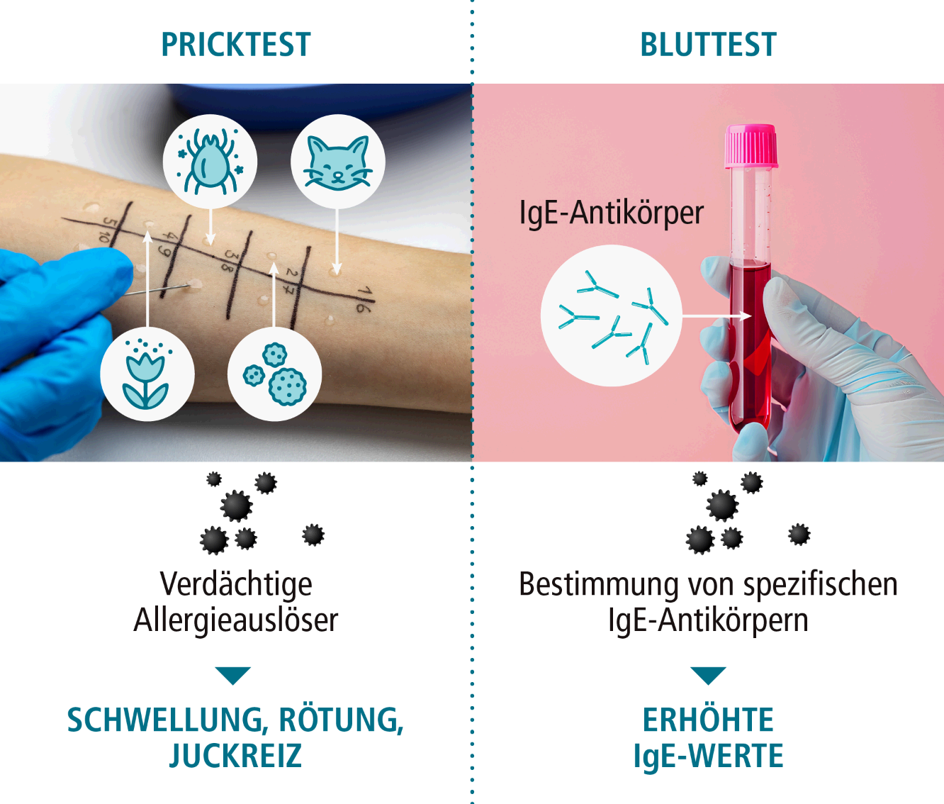allergie-diagnose-bluttest-pricktest