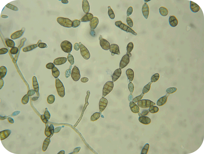 schimmelpilzallergie - alternaria