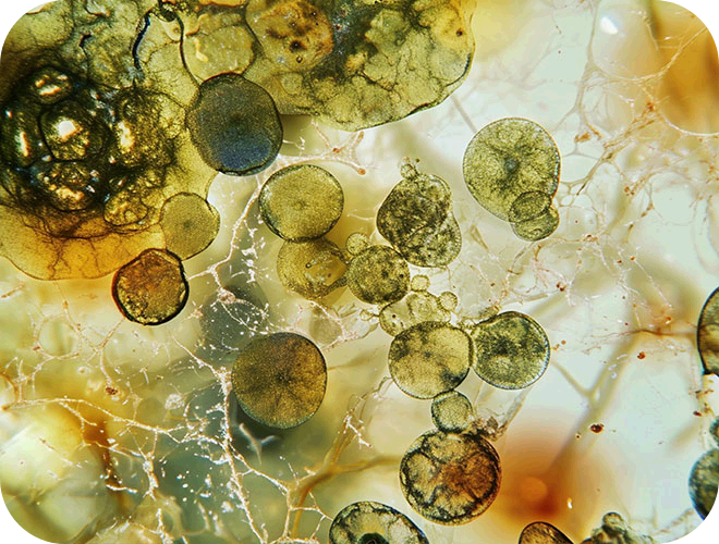 schimmelpilzallergie-penicillium