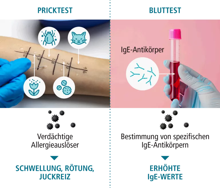 allergie-diagnose-bluttest-pricktest