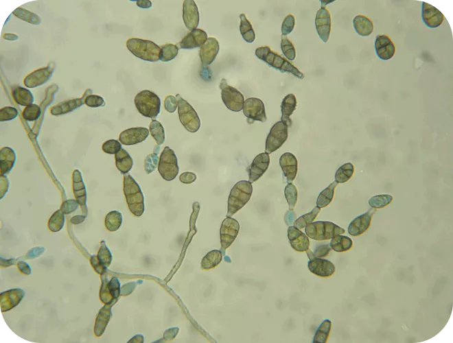 schimmelpilzallergie - alternaria